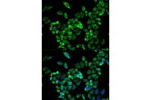 Immunofluorescence analysis of A549 cell using AOC3 antibody. (AOC3 anticorps  (AA 27-190))