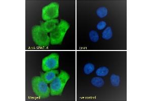 (ABIN570832) Immunofluorescence analysis of paraformaldehyde fixed A431 cells, permeabilized with 0. (SPAG16 anticorps  (AA 139-152))