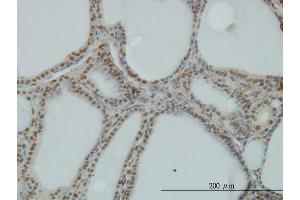 Immunoperoxidase of monoclonal antibody to POLR1C on formalin-fixed paraffin-embedded human thyroid nodular goiter. (POLR1C anticorps  (AA 1-346))