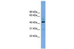 Image no. 1 for anti-UDP-Gal:betaGlcNAc beta 1,4- Galactosyltransferase, Polypeptide 2 (B4GALT2) (AA 251-300) antibody (ABIN6744776)