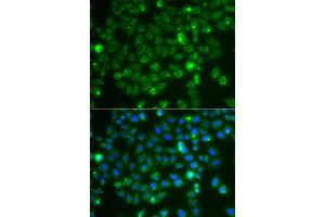 Immunofluorescence analysis of A549 cells using RAC1 antibody. (RAC1 anticorps)