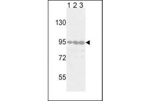 Western blot analysis of DDR2 antibody in Jurkat (lane 1), 293 (2) and HeLa (3) lysate.