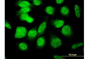 Immunofluorescence of monoclonal antibody to E4F1 on HeLa cell. (E4F1 anticorps  (AA 685-784))