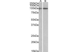 ABIN1590055 (1 µg/mL) staining of A549 (A) and Jurkat (B) lysates (35 µg protein in RIPA buffer). (HIC1 anticorps  (AA 193-204))