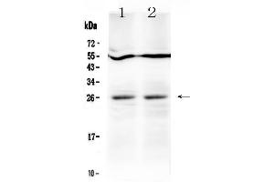 Western blot analysis of LIGHT  using anti-LIGHT  antibody . (TNFSF14 anticorps  (AA 59-239))