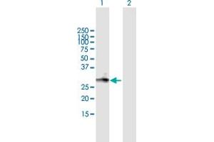 Western Blot analysis of MGC3036 expression in transfected 293T cell line by MGC3036 MaxPab polyclonal antibody. (LRRC61 anticorps  (AA 1-259))
