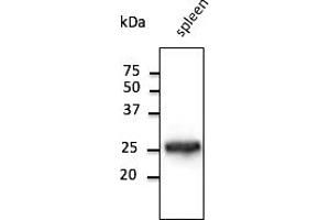 Western Blotting (WB) image for anti-RAB5A, Member RAS Oncogene Family (RAB5A) (C-Term) antibody (ABIN1440056)
