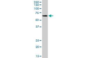 SLC17A4 monoclonal antibody (M03), clone 3E4.