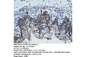 Human Stomach (APOBEC3G anticorps  (N-Term))
