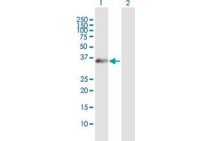 Western Blot analysis of XPA expression in transfected 293T cell line by XPA MaxPab polyclonal antibody. (XPA anticorps  (AA 1-273))