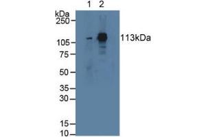 Western blot analysis of (1) Rat Serum and (2) Mouse Lung Tissue. (STAT2 anticorps  (AA 587-838))