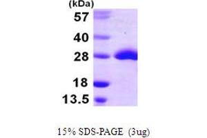 SDS-PAGE (SDS) image for Methionine Sulfoxide Reductase A (MSRA) (AA 1-212) protein (His tag) (ABIN667438) (MSRA Protein (AA 1-212) (His tag))