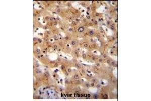GGCX Antibody (Center) (ABIN655069 and ABIN2844699) immunohistochemistry analysis in formalin fixed and paraffin embedded human liver tissue followed by peroxidase conjugation of the secondary antibody and DAB staining.