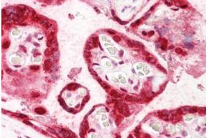 Anti-HMGB3 antibody IHC staining of human placenta.