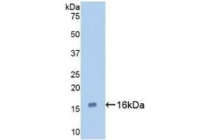 Detection of Recombinant GAL7, Human using Monoclonal Antibody to Galectin 7 (GAL7)