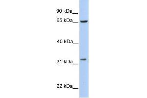 WB Suggested Anti-PBK Antibody Titration:  0. (PBK anticorps  (N-Term))