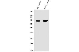 Western blot analysis of IFT88 using anti-IFT88 antibody (ABIN7600458).