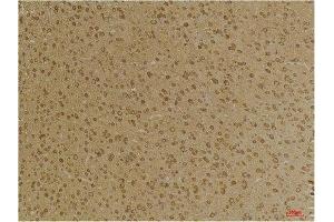 Immunohistochemistry (IHC) analysis of paraffin-embedded Mouse Brain Tissue using GABA A Receptor gamma2 Rabbit Polyclonal Antibody diluted at 1:200. (GABRG2 anticorps)