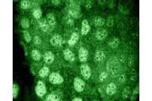 A431 cells were serum starved and treated with EGF (100 ng/ml) for 5 minutes, then fixed in 1:1 methanol-acetone for 10 minutes at -20°C.