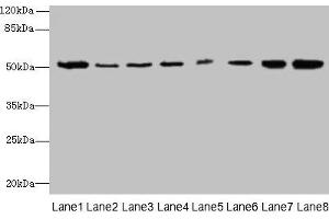 Western blot All lanes: PGS1 antibody at 2 μg/mL Lane 1: Mouse liver tissue Lane 2: Hela whole cell lysate Lane 3: Jurkat whole cell lysate Lane 4: HepG2 whole cell lysate Lane 5: THP-1 whole cell lysate Lane 6: Mouse spleen tissue Lane 7: Mouse thymus tissue Lane 8: Mouse kidney tissue Secondary Goat polyclonal to rabbit IgG at 1/10000 dilution Predicted band size: 63, 52, 38, 6 kDa Observed band size: 52 kDa (PGS1 anticorps  (AA 110-400))