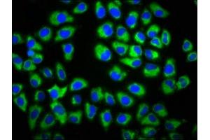 Immunofluorescence staining of Hela cells with ABIN7154478 at 1:133, counter-stained with DAPI. (GAS1 anticorps  (AA 248-318))