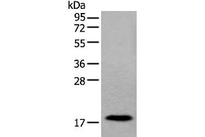 Western blot analysis of Human urinary bladder tissue lysate using MYL12B Polyclonal Antibody at dilution of 1:250 (MYL12B anticorps)