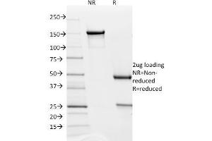 SDS-PAGE Analysis Purified PD-L2 Mouse Monoclonal Antibody (Z64P2D3*H4). (PDCD1LG2 anticorps  (AA 27-220))
