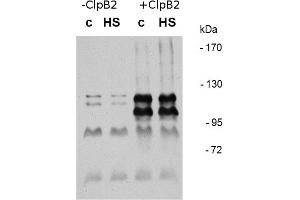 Image no. 2 for anti-ClpB2 Gene Product (CLPB2) antibody (ABIN334578) (CLPB2 anticorps)