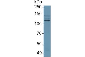 Western blot analysis of Human HeLa cell lysate, using Human PIK3Cb Antibody (1 µg/ml) and HRP-conjugated Goat Anti-Rabbit antibody ( (PIK3CB anticorps  (AA 524-703))