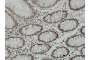 anti-Lysine (K)-Specific Demethylase 5B (KDM5B) (AA 231-319) antibody