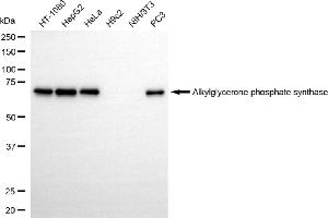 Western blotting analysis using alkylglycerone phosphate synthase antibody (ABIN7797582).