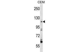 ARHGEF1 Antibody (N-term) western blot analysis in CEM cell line lysates (35µg/lane). (ARHGEF1 anticorps  (N-Term))