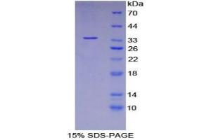 SDS-PAGE analysis of Human ASM Protein.