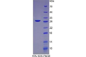 SDS-PAGE analysis of Rat C-Reactive Protein. (CRP Protéine)