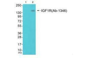 Western blot analysis of extracts from 293 cells (Lane 2), using IGF1R (Ab-1346) antiobdy. (IGF1R anticorps  (Tyr1346))