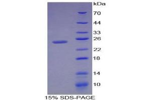 SDS-PAGE (SDS) image for Vitamin D-Binding Protein (GC) (AA 209-401) protein (His tag) (ABIN1879827)