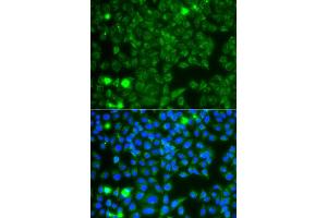 Immunofluorescence analysis of A549 cell using GBA3 antibody.