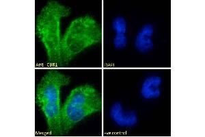 ABIN184784 Immunofluorescence analysis of paraformaldehyde fixed U251 cells, permeabilized with 0.
