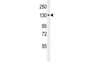 Western blot analysis of ITA6 antibody and HepG2 lysate; Ab used at 1:50.