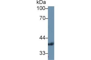 Western Blot; Sample: Human Serum; Primary Ab: 1µg/ml Rabbit Anti-Human PDHb Antibody Second Ab: 0. (PDHB anticorps  (AA 31-341))