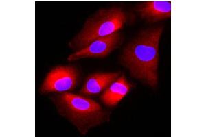 Immunofluorescence of human A549 cells stained with Hoechst 33342 (Blue) and monoclonal anti-human FUS2 antibody (1:500) with Texas Red (red). (NAT6 anticorps)