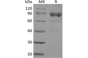 Western Blotting (WB) image for Signal-Regulatory Protein beta 2 (SIRPb2) protein (Fc Tag) (ABIN7319832) (SIRPb2 Protein (Fc Tag))