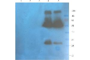 Western Blot using anti-OX40L antibody  Rat spleen (lane 1), rat muscle (lane 2), rat bladder (lane 3), human breast tumour (lane 4) and human thyroid tumour (lane 5) samples were resolved on a 10% SDS PAGE gel and blots probed with  at 1 µg/ml before being detected by a secondary antibody. (Recombinant CD40L (Ruplizumab Biosimilar) anticorps)