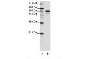 Image no. 1 for anti-Cas-Br-M (Murine) Ecotropic Retroviral Transforming Sequence-Like 1 (CBLL1) (C-Term) antibody (ABIN202651) (CBLL1 anticorps  (C-Term))