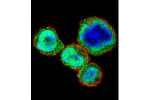 Confocal immunofluorescent analysis of RB1 Antibody  (ABIN1881730 and ABIN2840685) with MDA-M cell followed by Alexa Fluor 488-conjugated goat anti-rabbit lgG (green). (Retinoblastoma 1 anticorps  (AA 586-615))