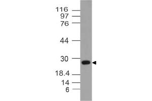 Image no. 1 for anti-14-3-3 theta (YWHAQ) antibody (ABIN5027747) (14-3-3 theta anticorps)