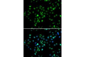 Immunofluorescence analysis of MCF7 cell using RBBP6 antibody. (RBBP6 anticorps)