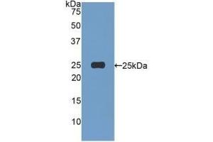 Detection of Recombinant AFM, Human using Polyclonal Antibody to Afamin (AFM) (Afamin anticorps  (AA 22-210))