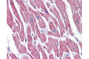 Anti-ATP5E antibody IHC of human heart.