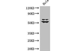 Western Blot Positive WB detected in: Hela whole cell lysate All lanes: KLF5 antibody at 3 μg/mL Secondary Goat polyclonal to rabbit IgG at 1/50000 dilution Predicted band size: 51, 34, 19, 42 kDa Observed band size: 51, 60 kDa (KLF5 anticorps  (AA 69-346))
